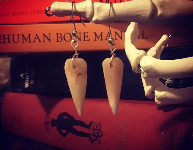 История: американка сделала серьги из своей челюсти