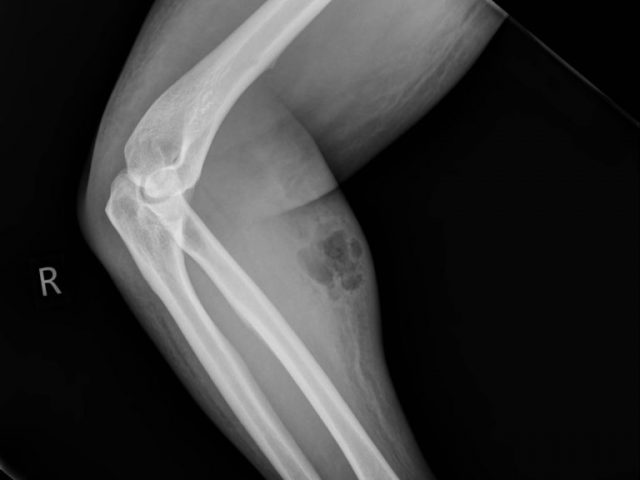 История: ирландец полтора года «лечился» инъекциями собственной спермы