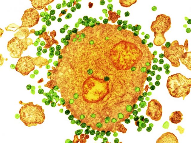 Зафиксирован второй в истории случай излечения от ВИЧ