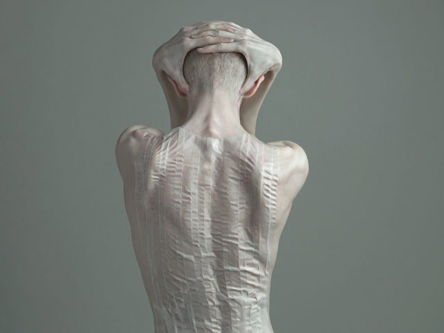 «Шутить про рак — нормально». Правила жизни людей с серьезными заболеваниями