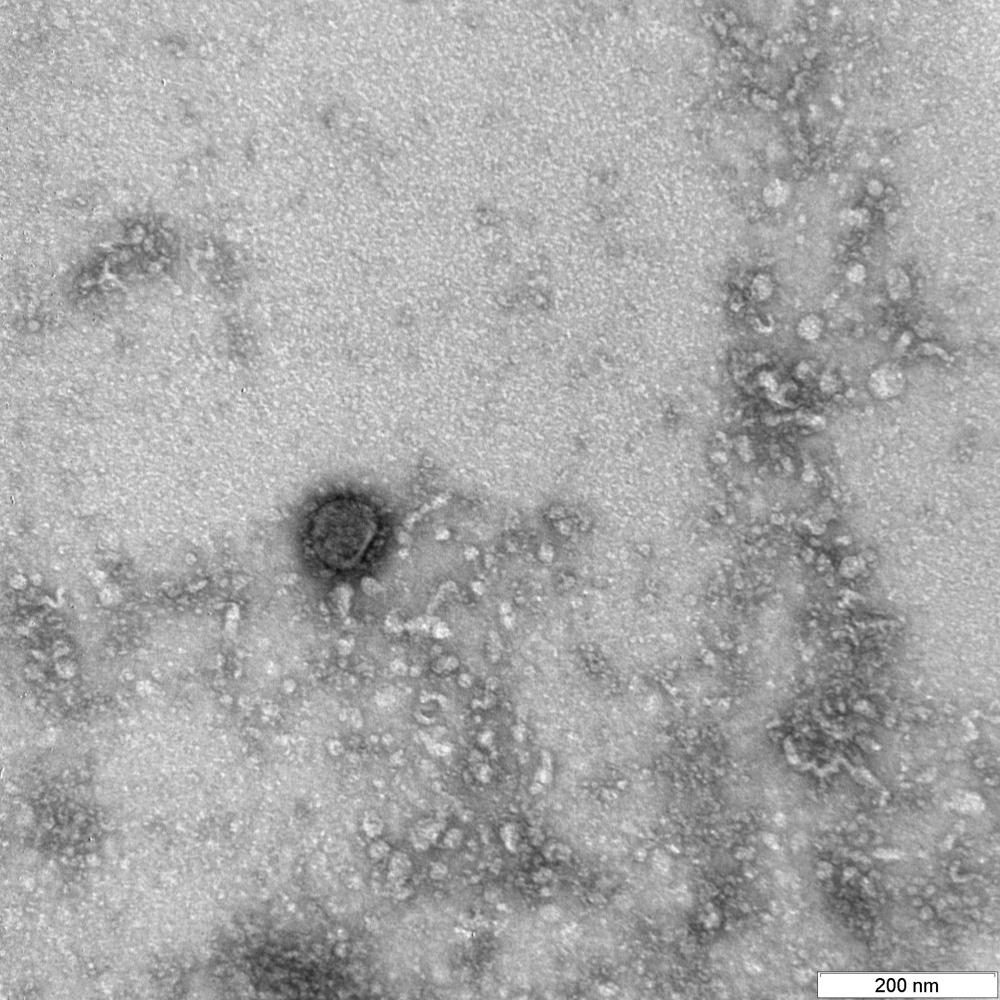 Лунная болезнь. Вирус Covid 19 под микроскопом. Covid-19 под микроскопом. Covid 19 как выглядит под микроскопом. Коронавирус Covid-19 под микроскопом.