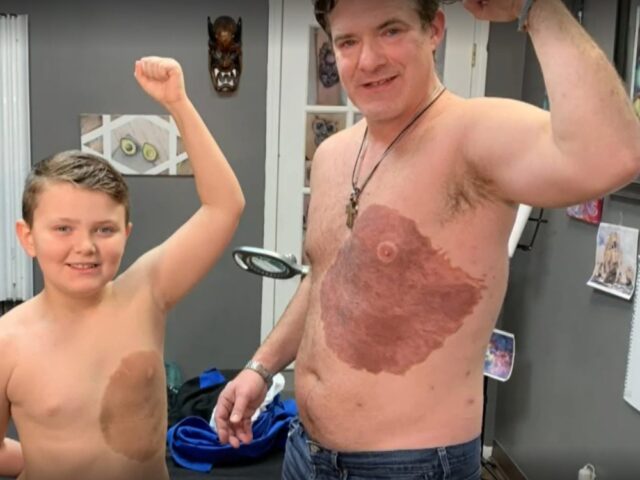 История: канадец набил себе родимое пятно, как у сына, чтобы избавить его от комплексов