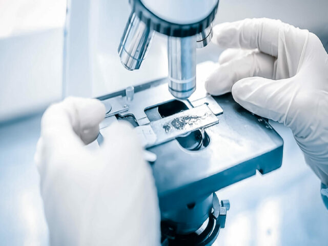 Искусственный интеллект научили диагностировать рак простаты по анализу мочи