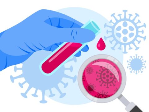 В России зарегистрировали первый экспресс-тест на антитела для вакцинировавшихся от ковида. Его можно делать дома
