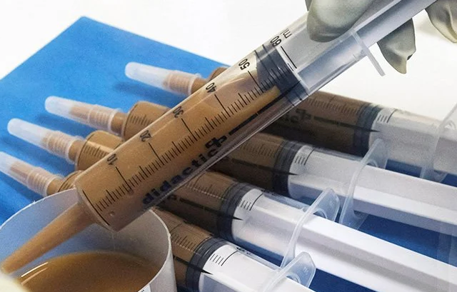 В Польше больные ковидом выздоровели после пересадки кала