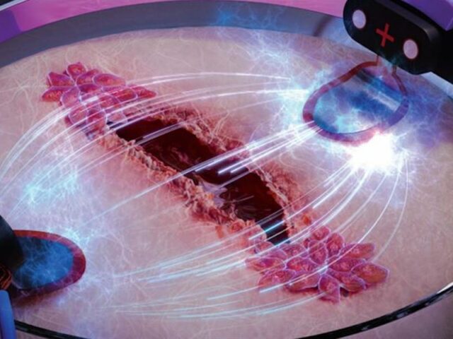 Исследование: раны заживают в три раза быстрее под воздействием электричества
