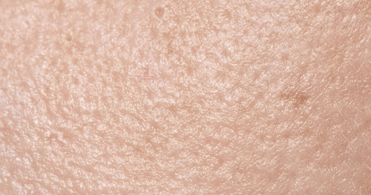 Исследование: растяжение кожи — эффективный способ введения препаратов без использования игл