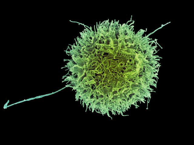 Исследование: как модифицированные клетки — «естественные киллеры» могут помочь в борьбе с раком