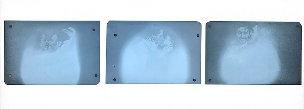 фото на рентгеновской пленке