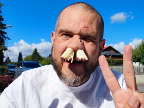 Мужчина из Швеции засунул себе в нос 81 спичку и попал в Книгу рекордов Гиннесса