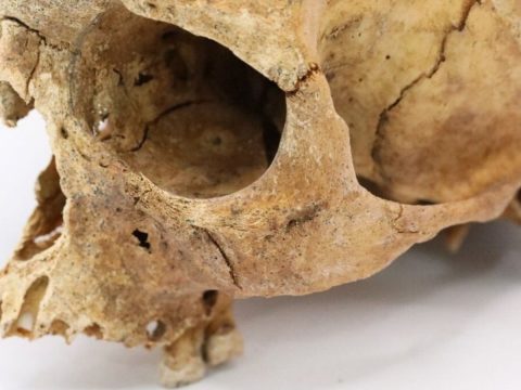 Российские антропологи описали маркеры стресса у средневековых людей