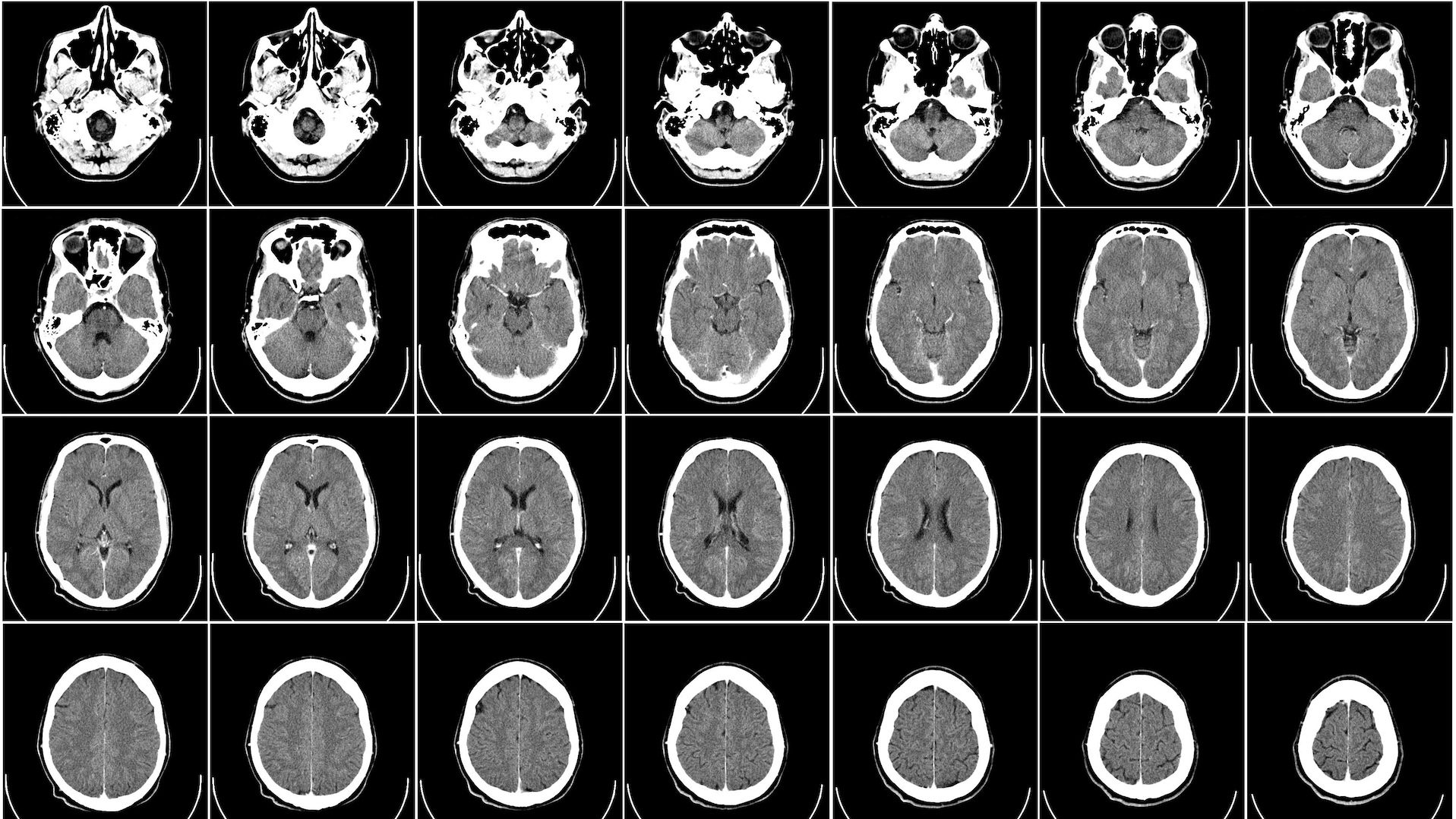 мозг, томография