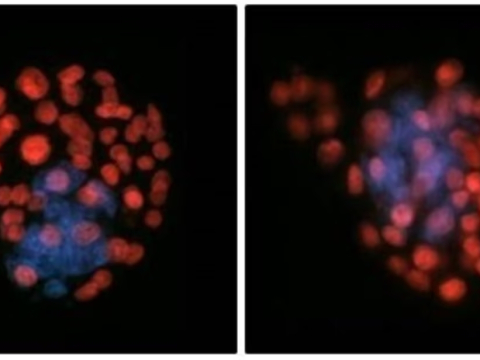 Исследование: сперматозоиды теряют равновесие в космосе