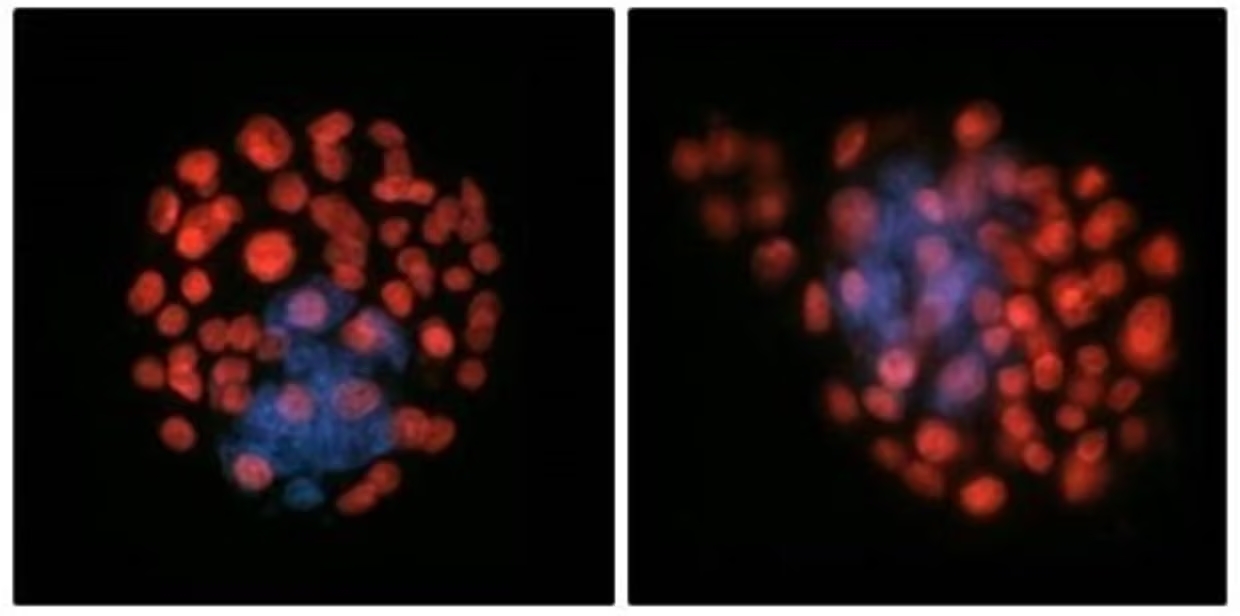 Исследование: сперматозоиды теряют равновесие в космосе