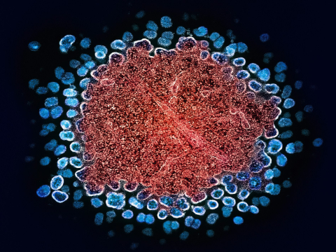 Норвежец полностью излечился от ВИЧ благодаря пересадке стволовых клеток брата