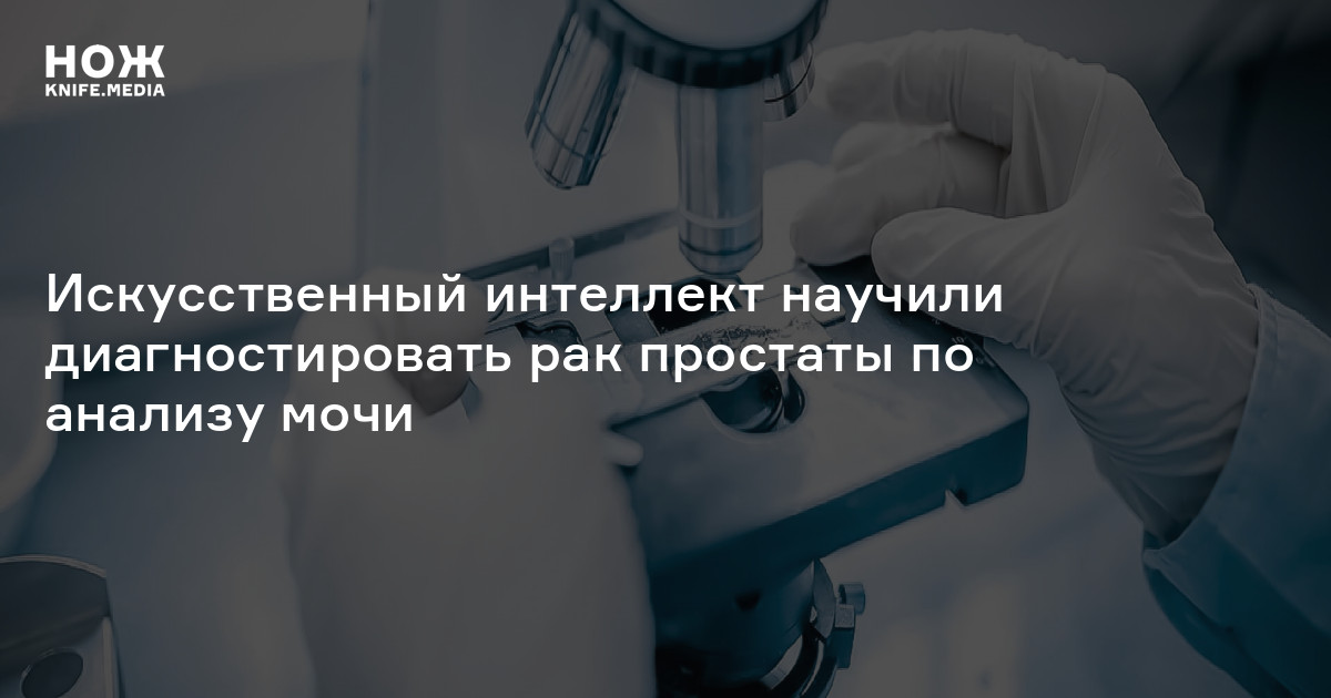 Моча при раке простаты. Российские ученые научились выявлять болезни почек по капле крови.