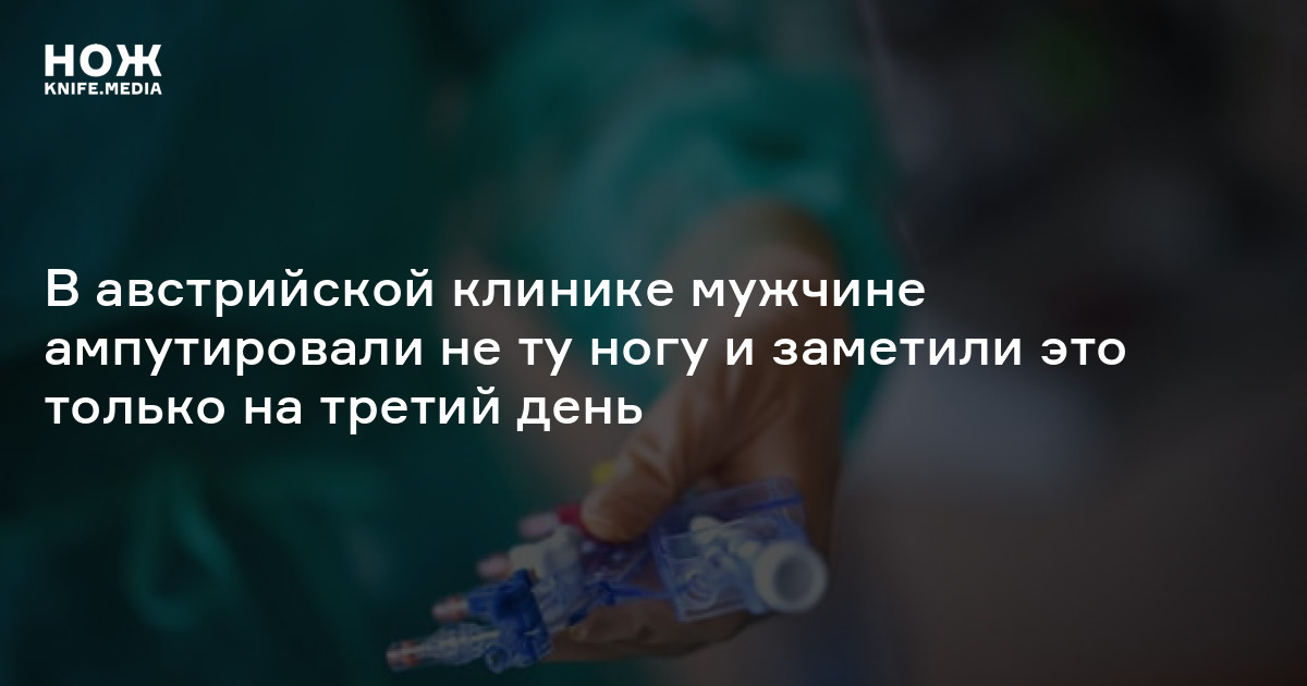 В австрийской клинике мужчине ампутировали не ту ногу и заметили это ...