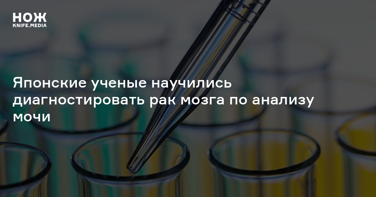 Японские ученые научились диагностировать рак мозга по анализу мочи — Нож