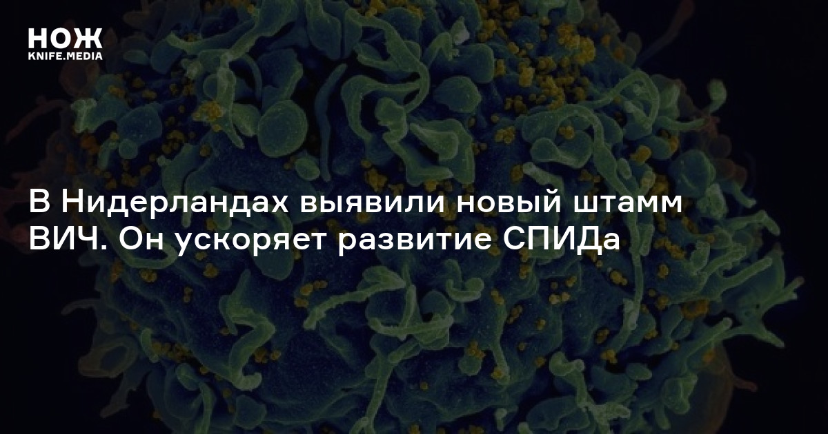 Центр по профилактике и борьбе со спидом и инфекционными иваново. Вич инфицированные люди. Вич позитивные активисты. Как не заразиться вич. Вич новости на сегодня.