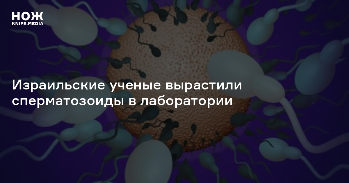 Израильские ученые вырастили сперматозоиды в лаборатории — Нож