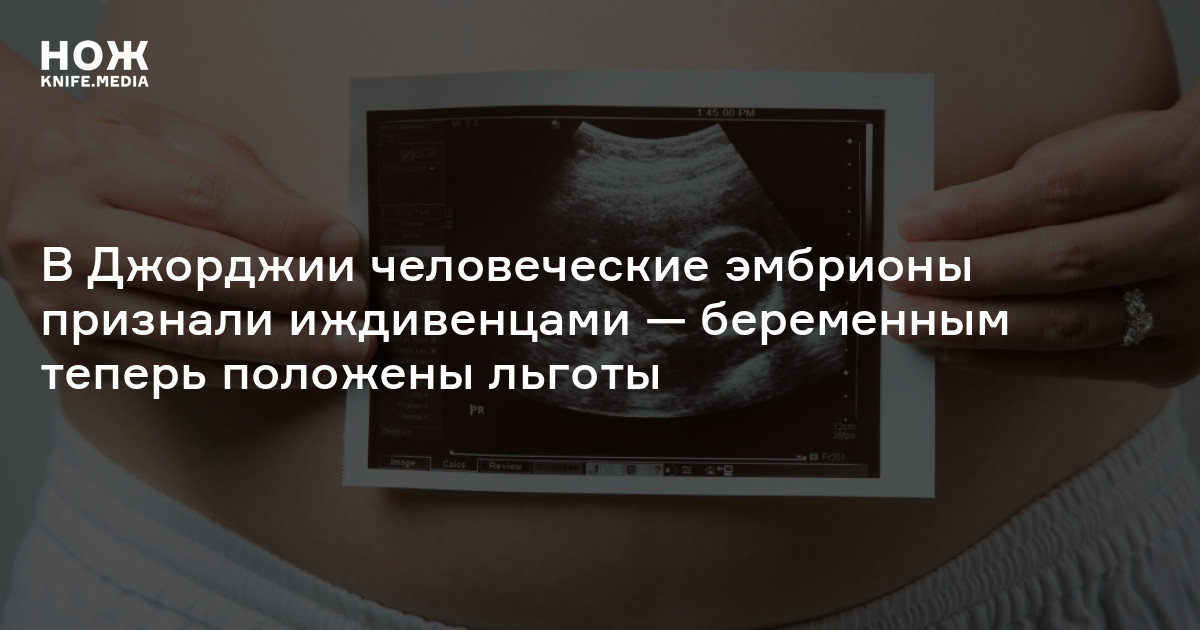 Закон о признании эмбриона на жизнь. В США эмбрионы признали иждивенцами
