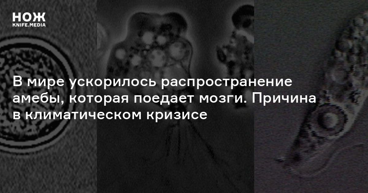 В мире ускорилось распространение амебы, которая поедает мозги. Причина ...