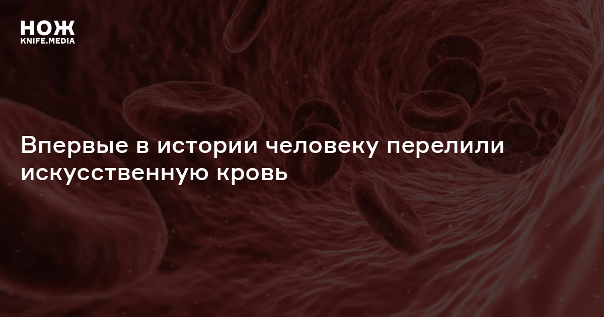 Впервые в истории человеку перелили искусственную кровь — Нож