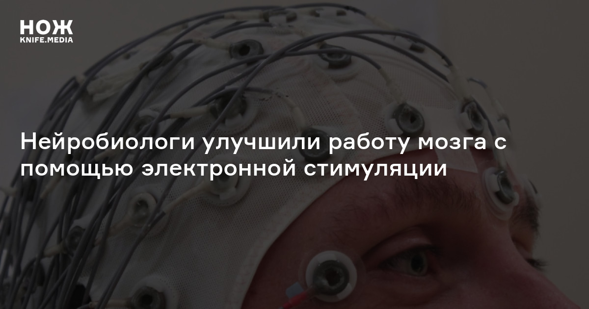 Нейробиологи улучшили работу мозга с помощью электронной стимуляции — Нож