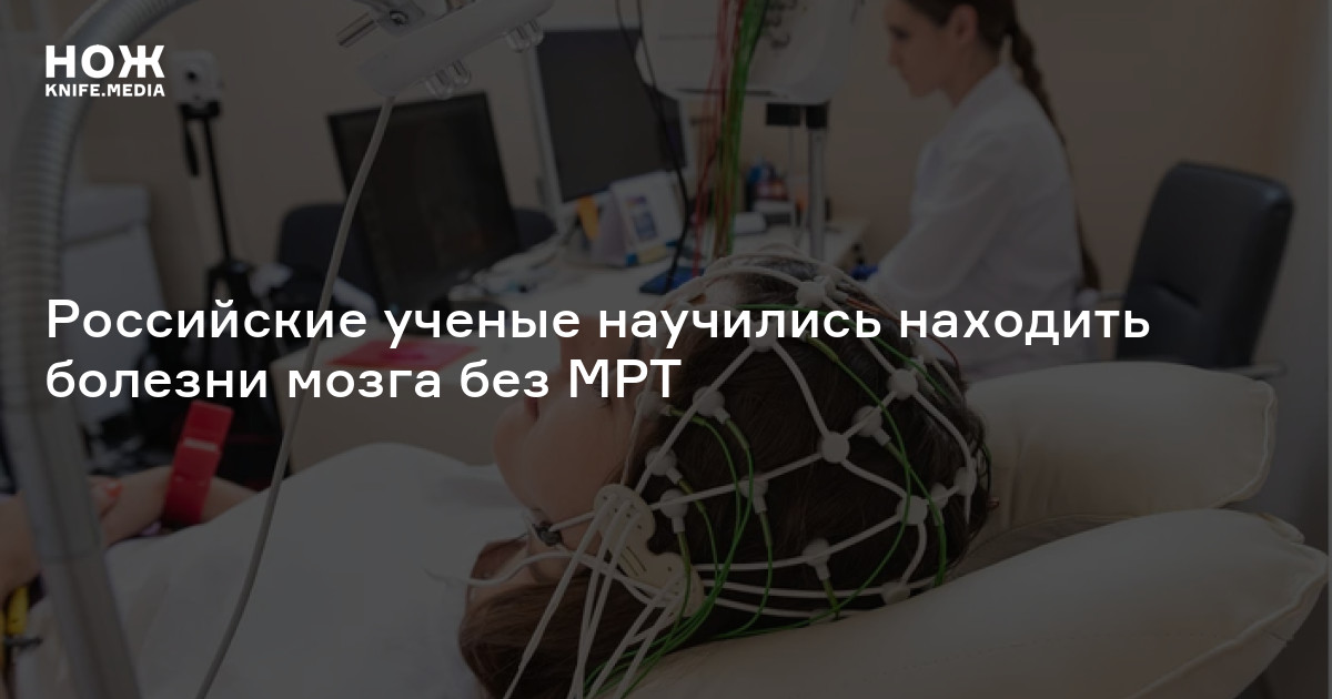 Российские ученые научились находить болезни мозга без МРТ — Нож