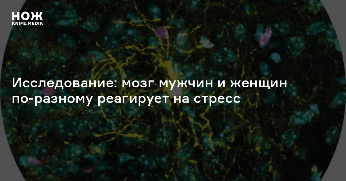 Исследование: мозг мужчин и женщин по-разному реагирует на стресс —Нож