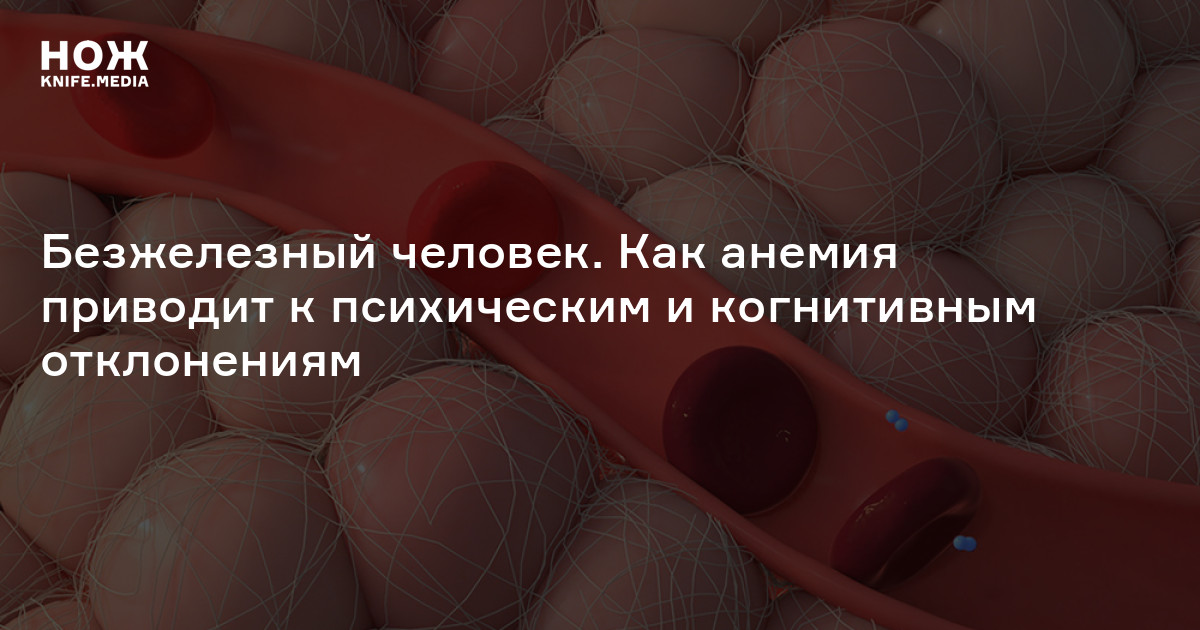 Железодефицитная анемия — Нож