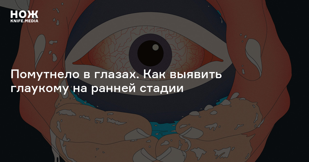 Лечение глаукомы — Нож