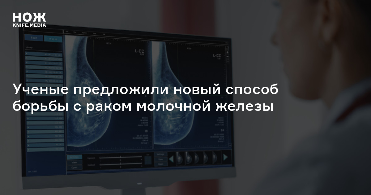 Ученые предложили новый способ борьбы с агрессивным раком молочной ...