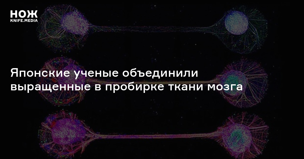 Японские ученые объединили выращенные в пробирке ткани мозга — Нож