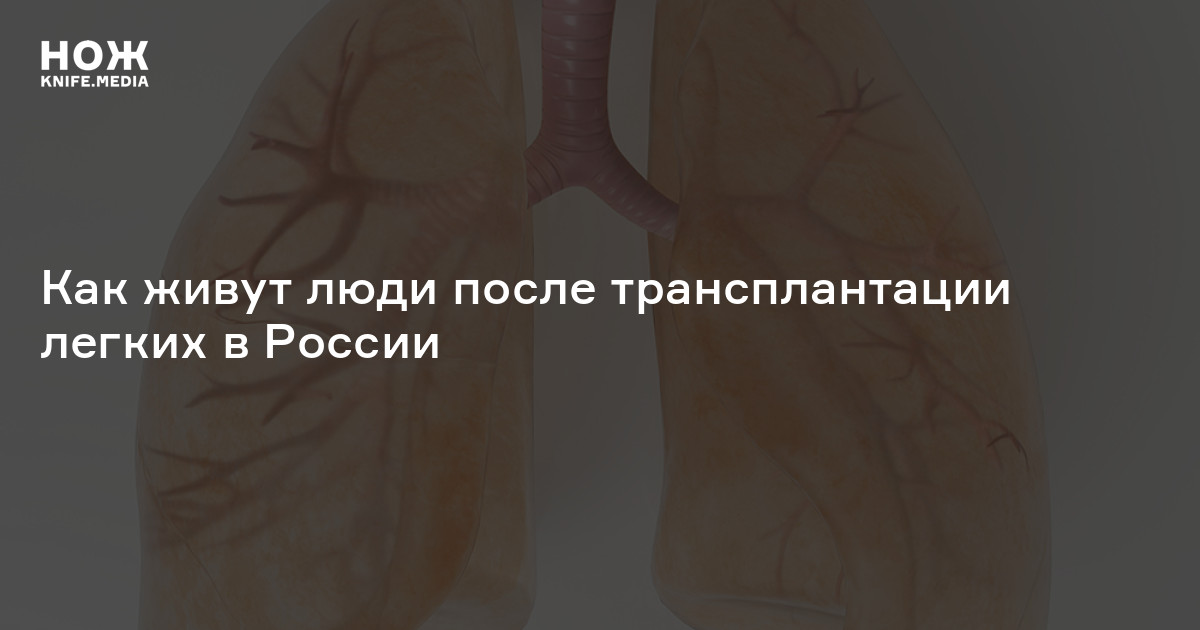 «Мы знаем, что можем умереть в любой момент. Но эти мысли отходят на ...
