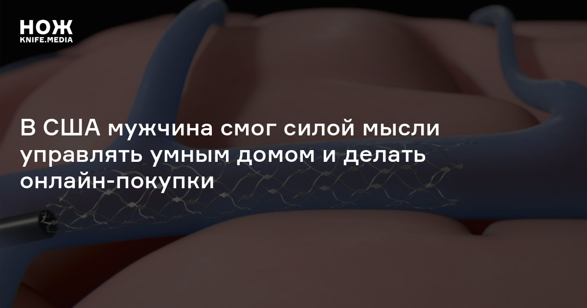В США мужчина смог силой мысли управлять умным домом и делать онлайн-покупки