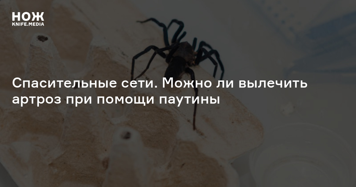 Спасительные сети. Можно ли вылечить артроз при помощи паутины