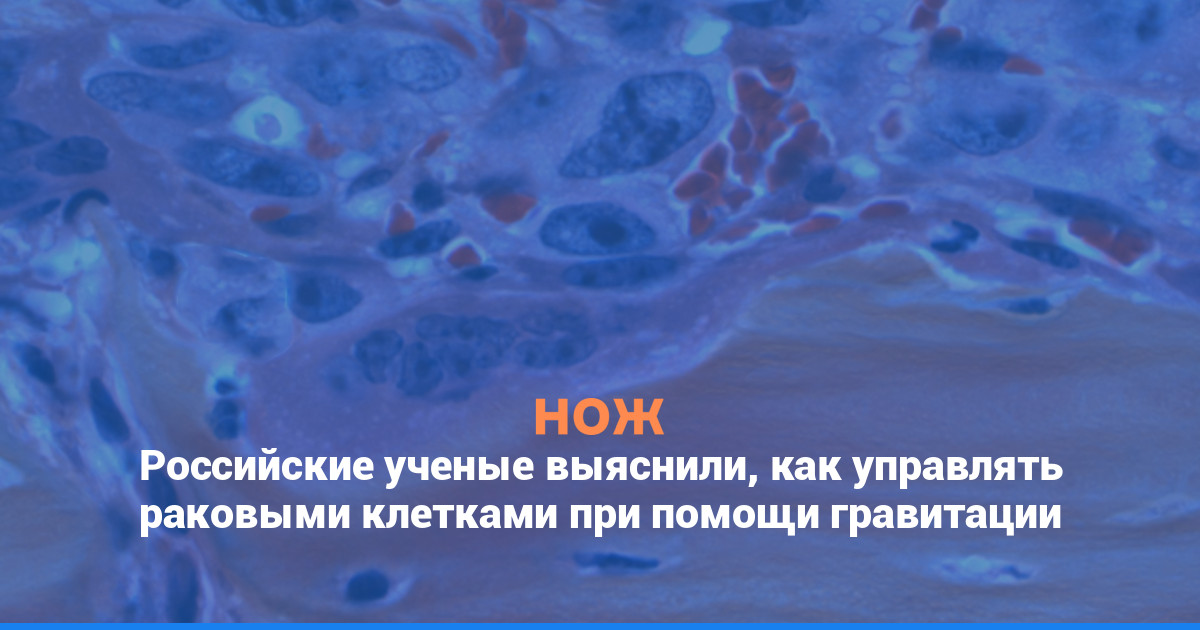 Российские ученые выяснили, как управлять раковыми клетками при помощи гравитации