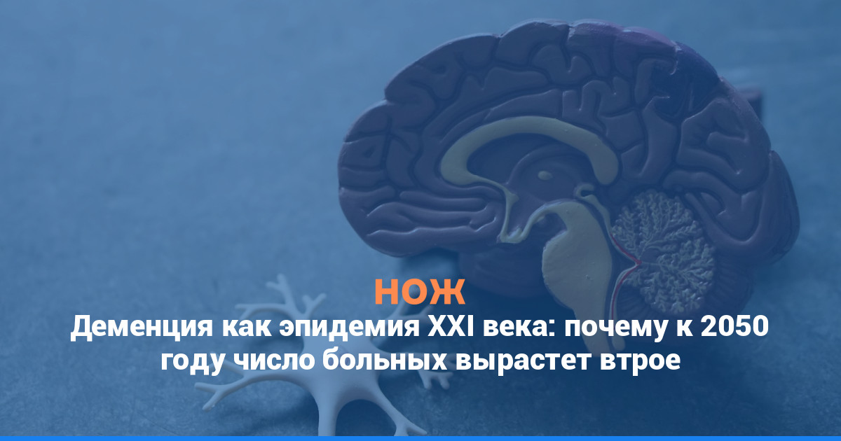 Деменция как эпидемия ХХІ века: почему к 2050 году число больных вырастет втрое