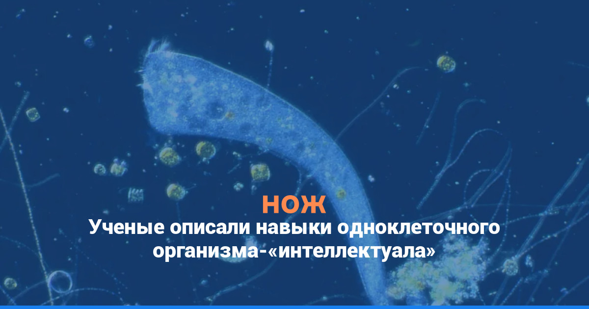 Ученые описали навыки одноклеточного организма-«интеллектуала»