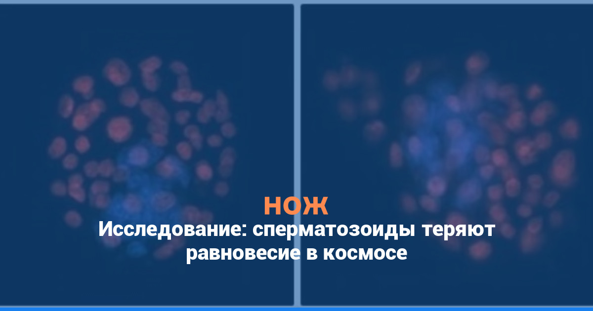 Исследование: сперматозоиды теряют равновесие в космосе