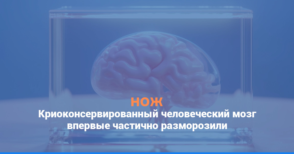 Криоконсервированный человеческий мозг впервые частично разморозили
