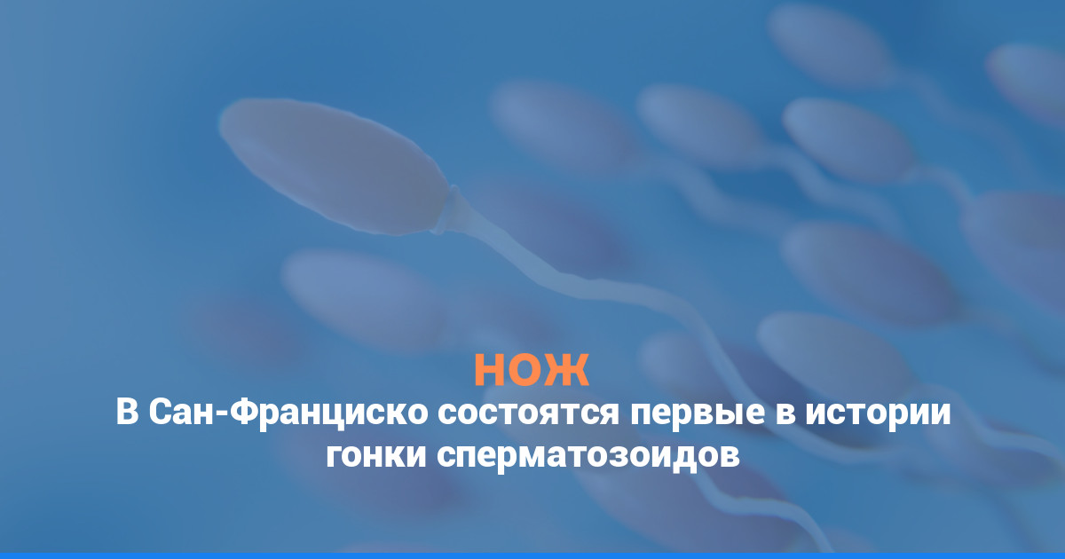 В Сан-Франциско состоятся первые в истории гонки сперматозоидов