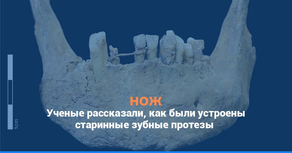 Ученые рассказали, как были устроены старинные зубные протезы