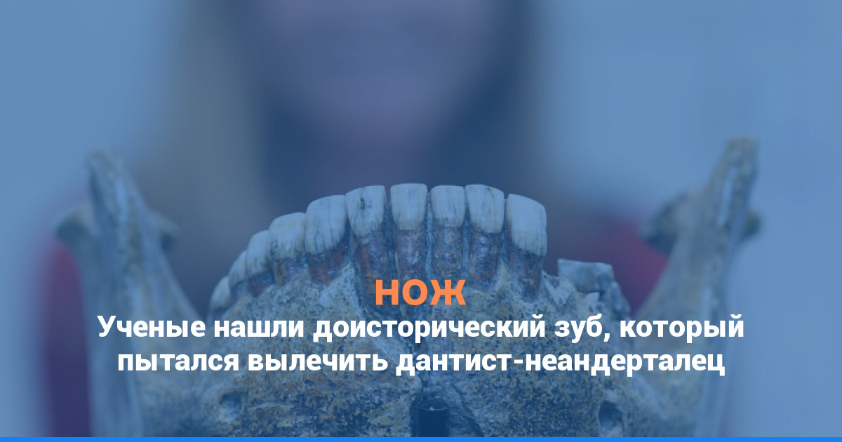 Ученые нашли доисторический зуб, который пытался вылечить дантист-неандерталец