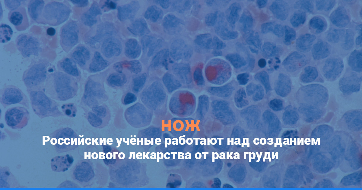 Российские учёные работают над созданием нового лекарства от рака груди